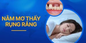 Nằm mơ thấy rụng răng hàm trên