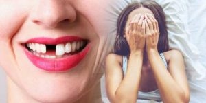 nằm mơ thấy rụng răng không chảy máu